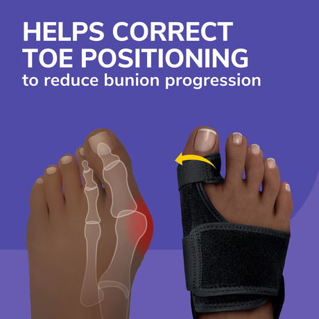 Bunion Relief & Toe Corrector