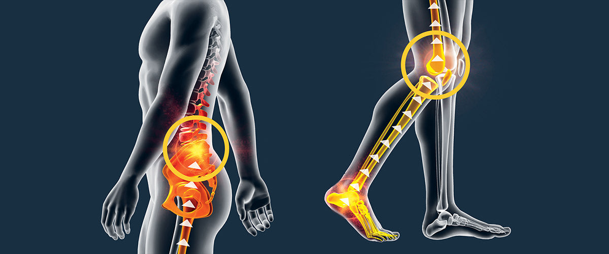 That Pain in Your Knees and Lower Back Could Be Linked to Your Feet an –  DrScholls