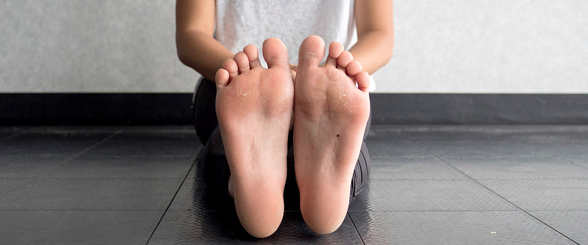 Tips to Manage Flat Feet – DrScholls