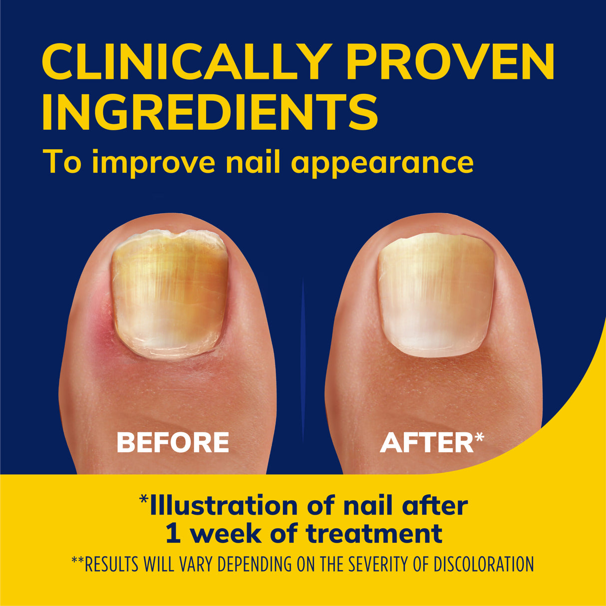 image of clinically proven ingredients to improve nail appearance