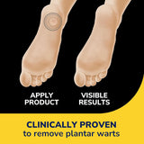 Clear Away® Plantar Wart Removers