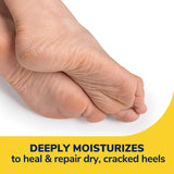 image of deeply moisturizes to heal and repair dry, cracked,heels