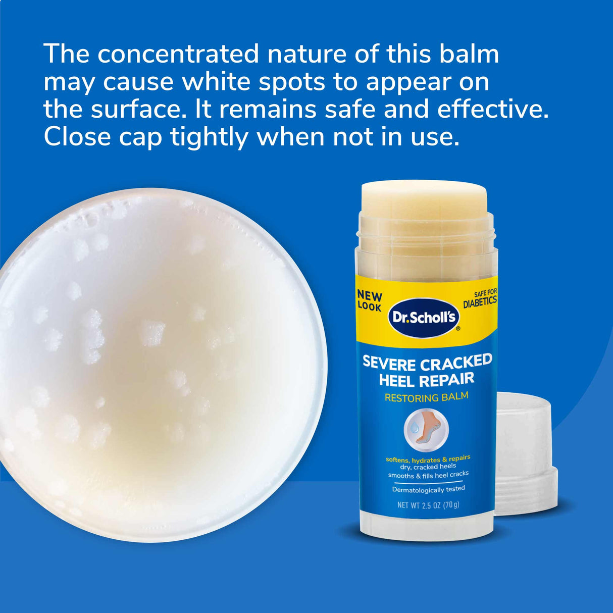 image of the concentrated nature of this balm may cause white spots to appear on the surface. It remains safe and effective
