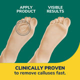 image of clinically proven to remove calluses fast