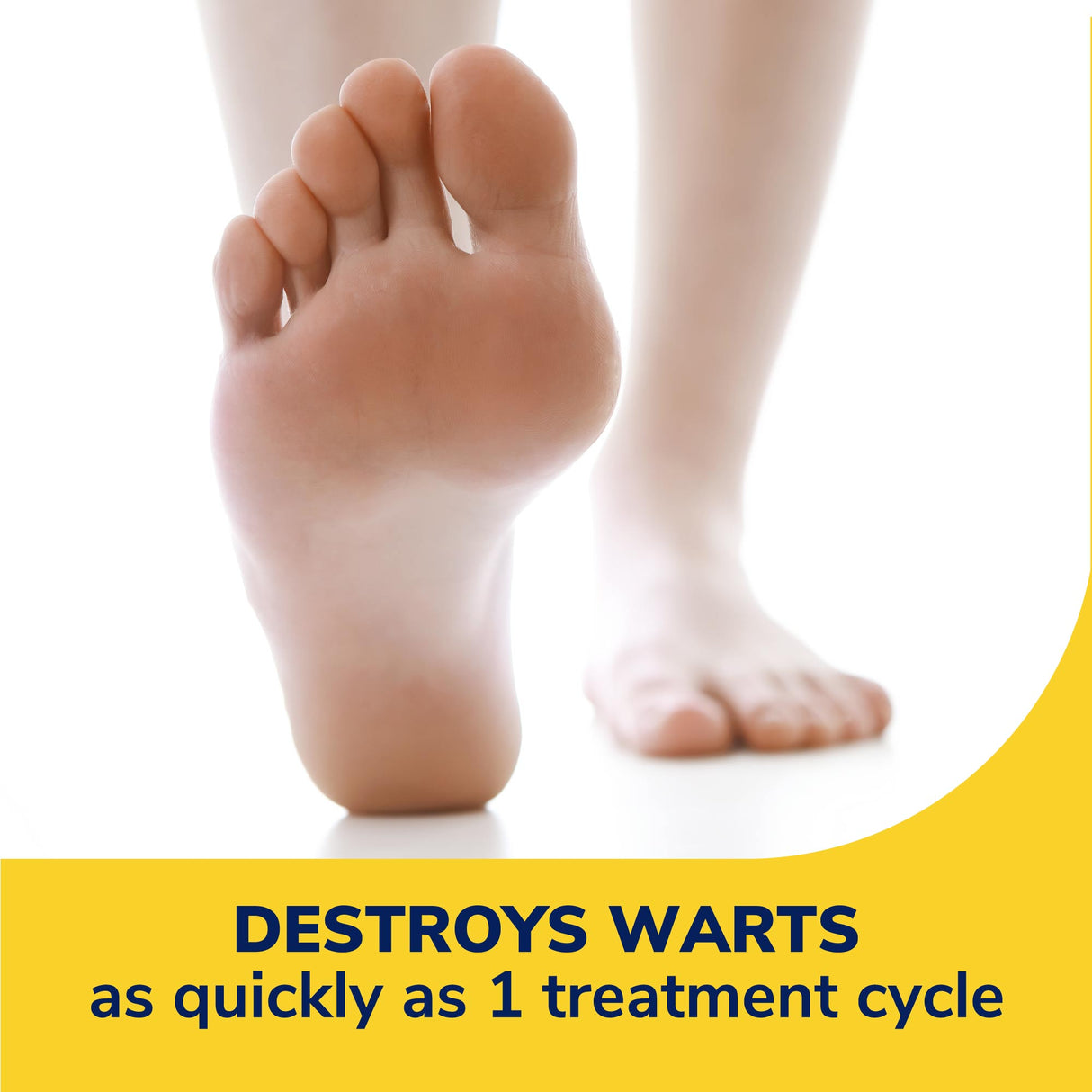 image of destroys warts as quickly as 1 treatment cycle