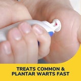 image of treats common & plantar warts fast