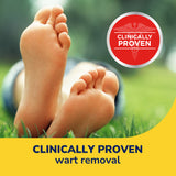 image of clincally proven wart removal