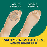 Extra Thick Callus Removers