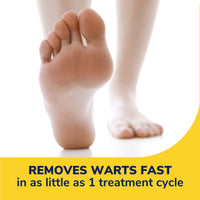 Freeze Away® Wart Remover