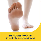 Freeze Away® Wart Remover