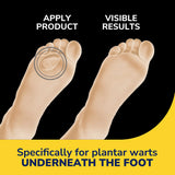 Plantar Wart Remover Seal & Heal Bandage with Hydrogel Technology