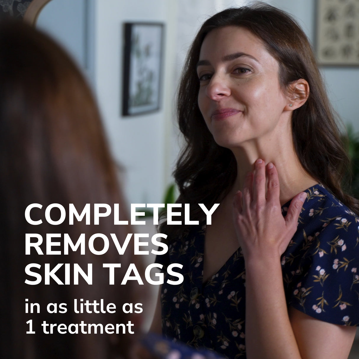 Freeze Away® Skin Tag Remover