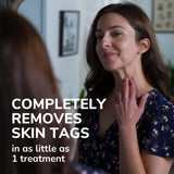 Freeze Away® Skin Tag Remover