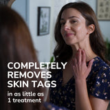 Freeze Away® Skin Tag Remover (2 Pack)
