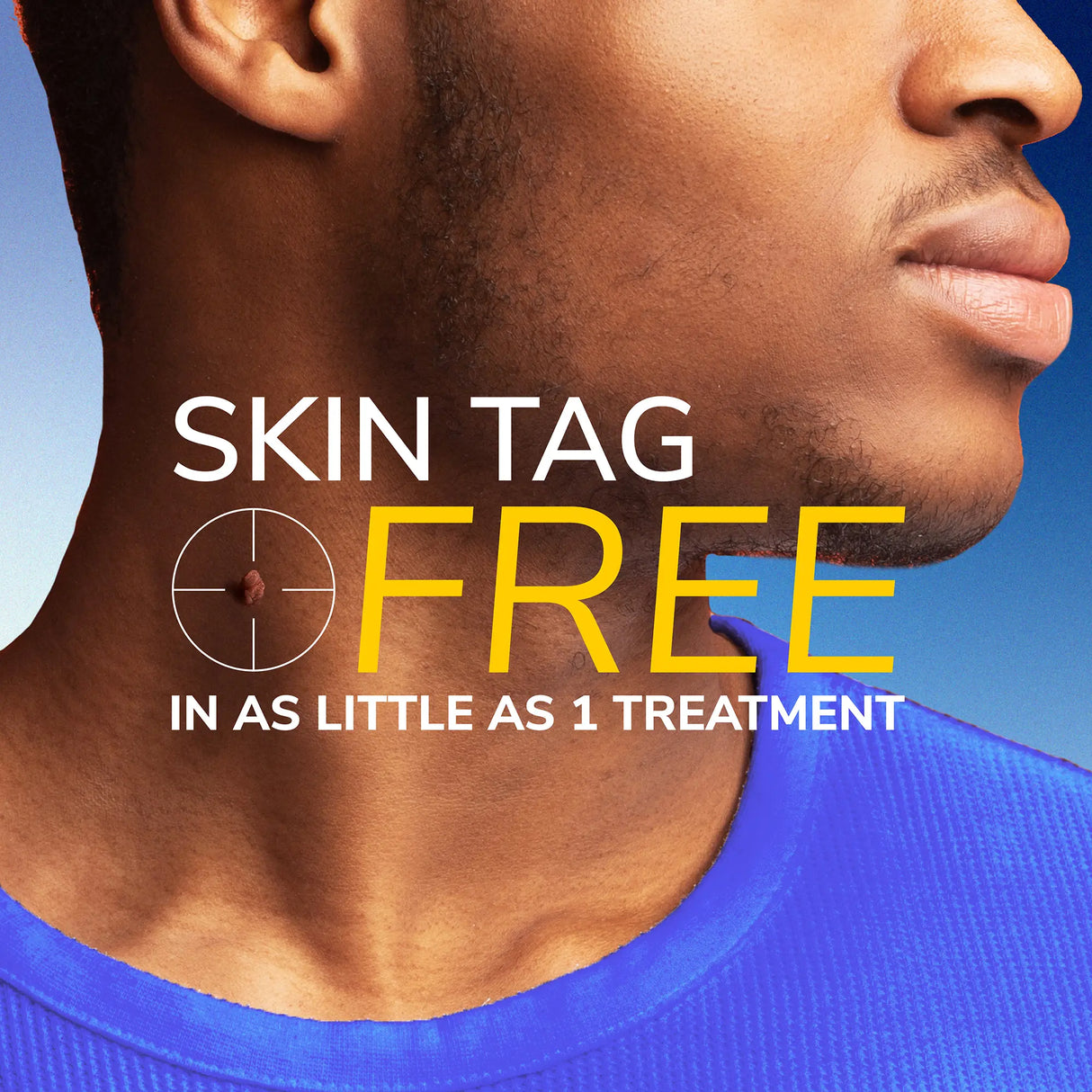 Freeze Away® Skin Tag Remover