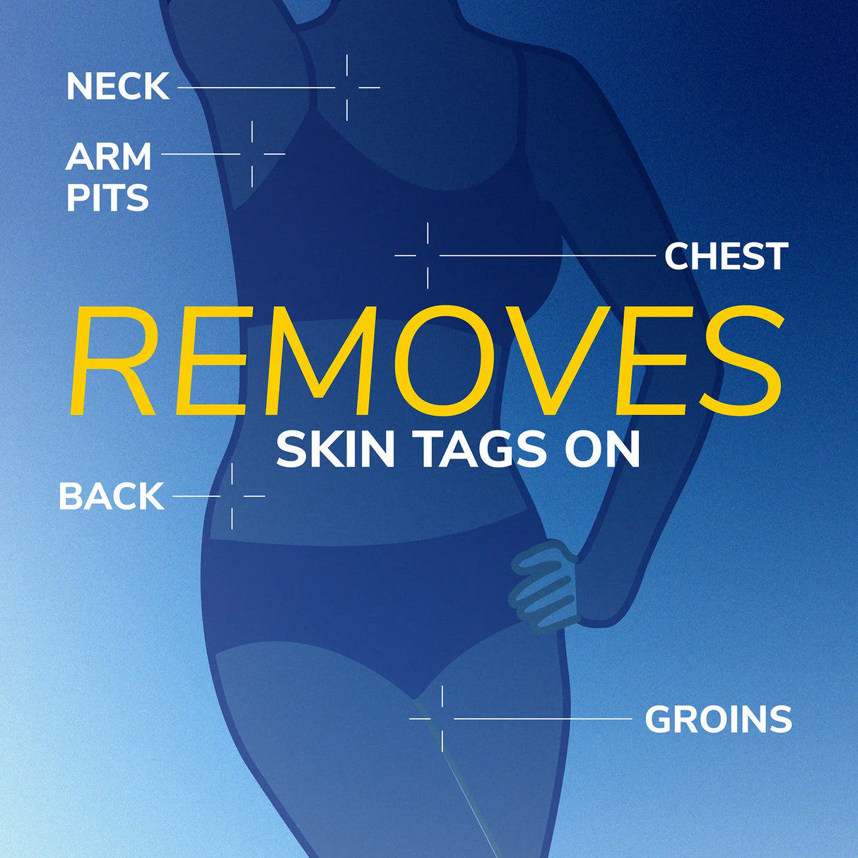 Freeze Away® Skin Tag Remover
