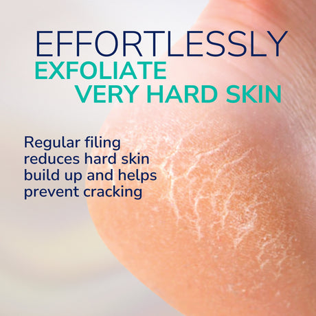 Callus Remover Electronic Foot File