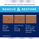 Skin Tag Complete Care