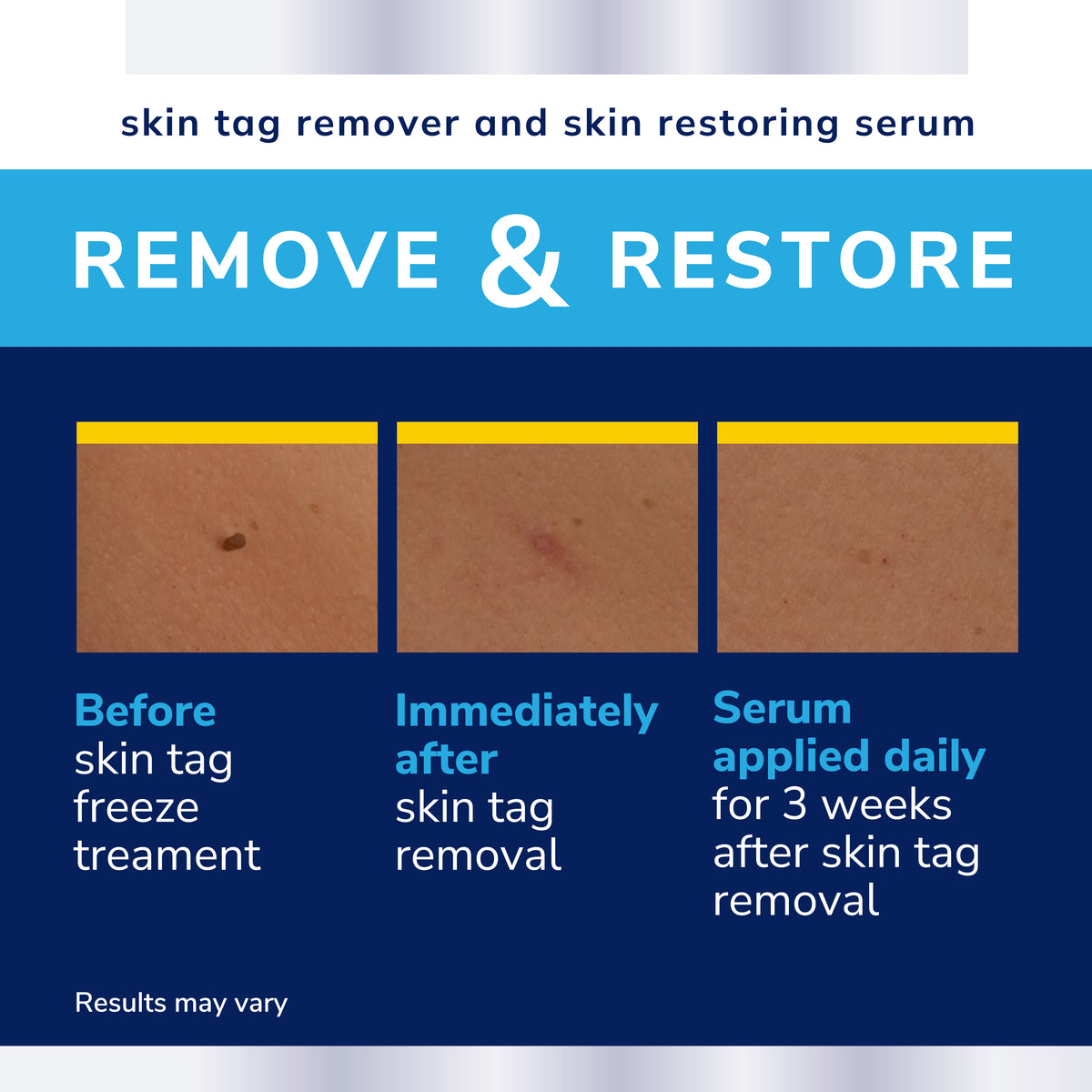 Skin Tags – DrScholls