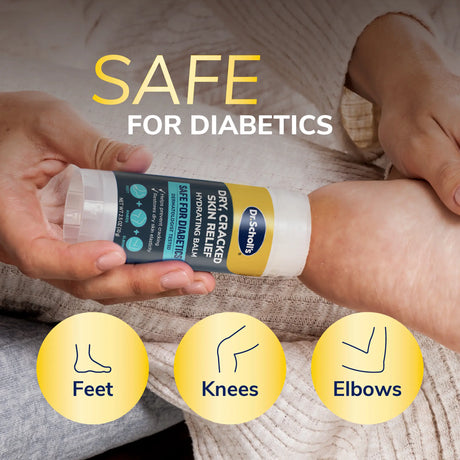 Hydrating skin balm being applied to knee area, with feet-knees-elbows icons