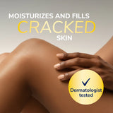 Dry, Cracked Skin Relief Hydrating Balm