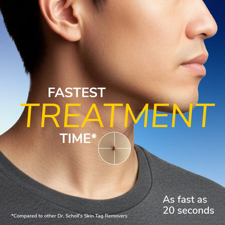 Targeted neck skin with circular reticle indicating a precise skin tag treatment area.