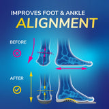 Flat Feet Support Insoles for Women