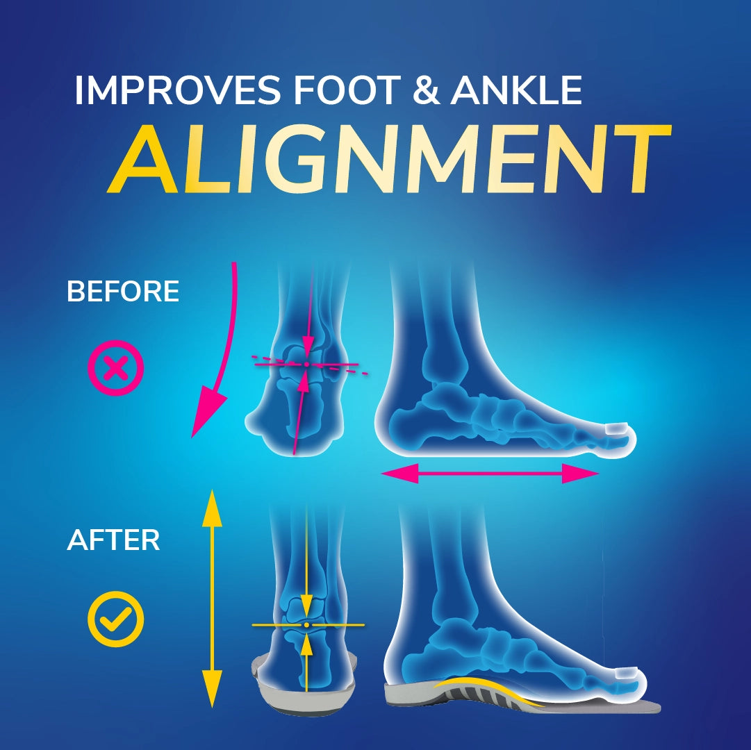 Flat Feet Support Insoles for Men