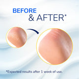 Severe Cracked Heel Repair Restoring Balm