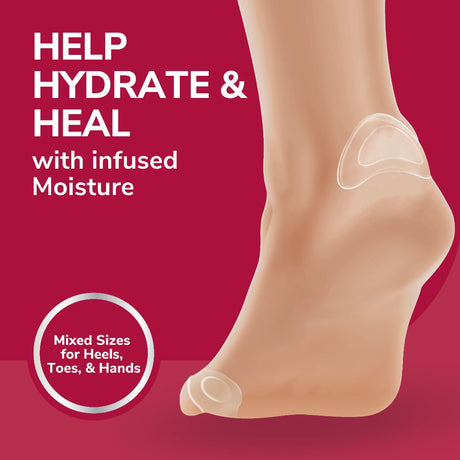 Clear hydrogel blister cushion on foot, mixed sizes for heels, toes, and hands