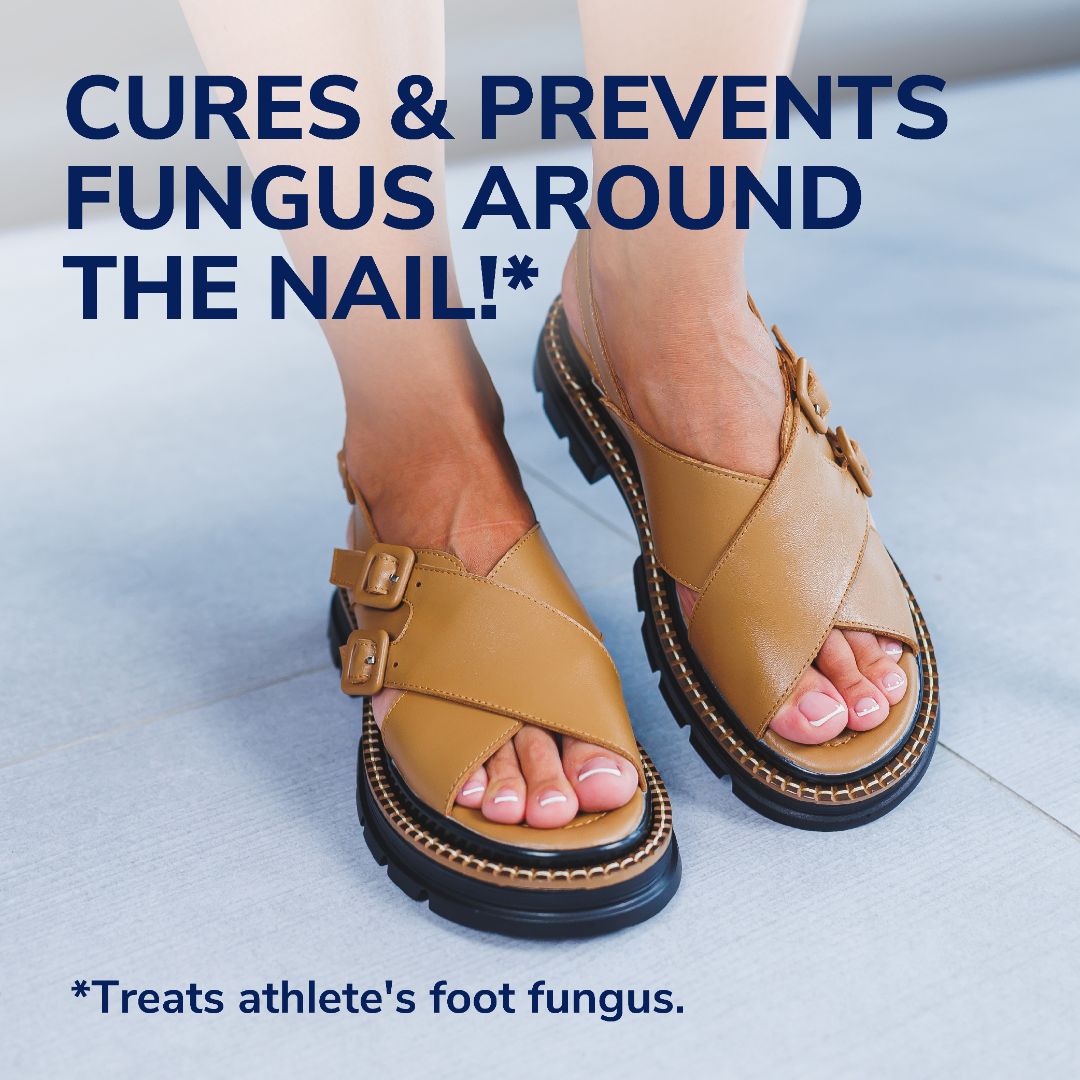 Toenail view in sandals for fungus treatment and prevention; feet shown
