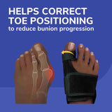 image of helps correct toe positioning to reduce bunion progression