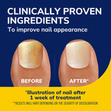 Fungal Nail Revitalizer Kit with Light-Activated Therapy