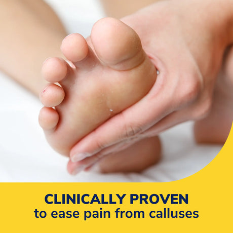 Hydrogel callus cushion pad placed under a foot for soft comfort