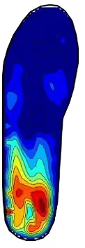 Colorful thermal or pressure map of a shoe insole with blue, red, and yellow colors.